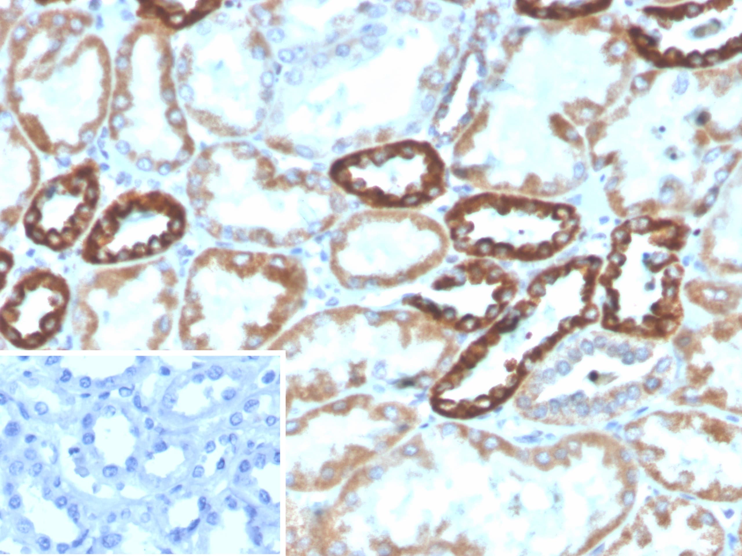 PLA2R1 Antibody (PLA2R1/4891) - Azide and BSA Free