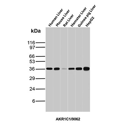 Aldo-keto Reductase 1C1/AKR1C1 Antibody (AKR1C1/9062) - Azide and BSA Free