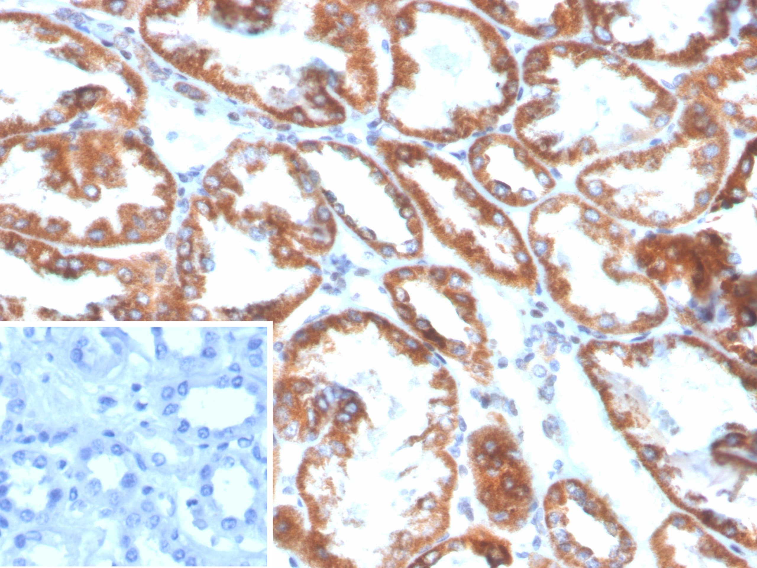 PLA2R1 Antibody (PLA2R1/4898) - Azide and BSA Free