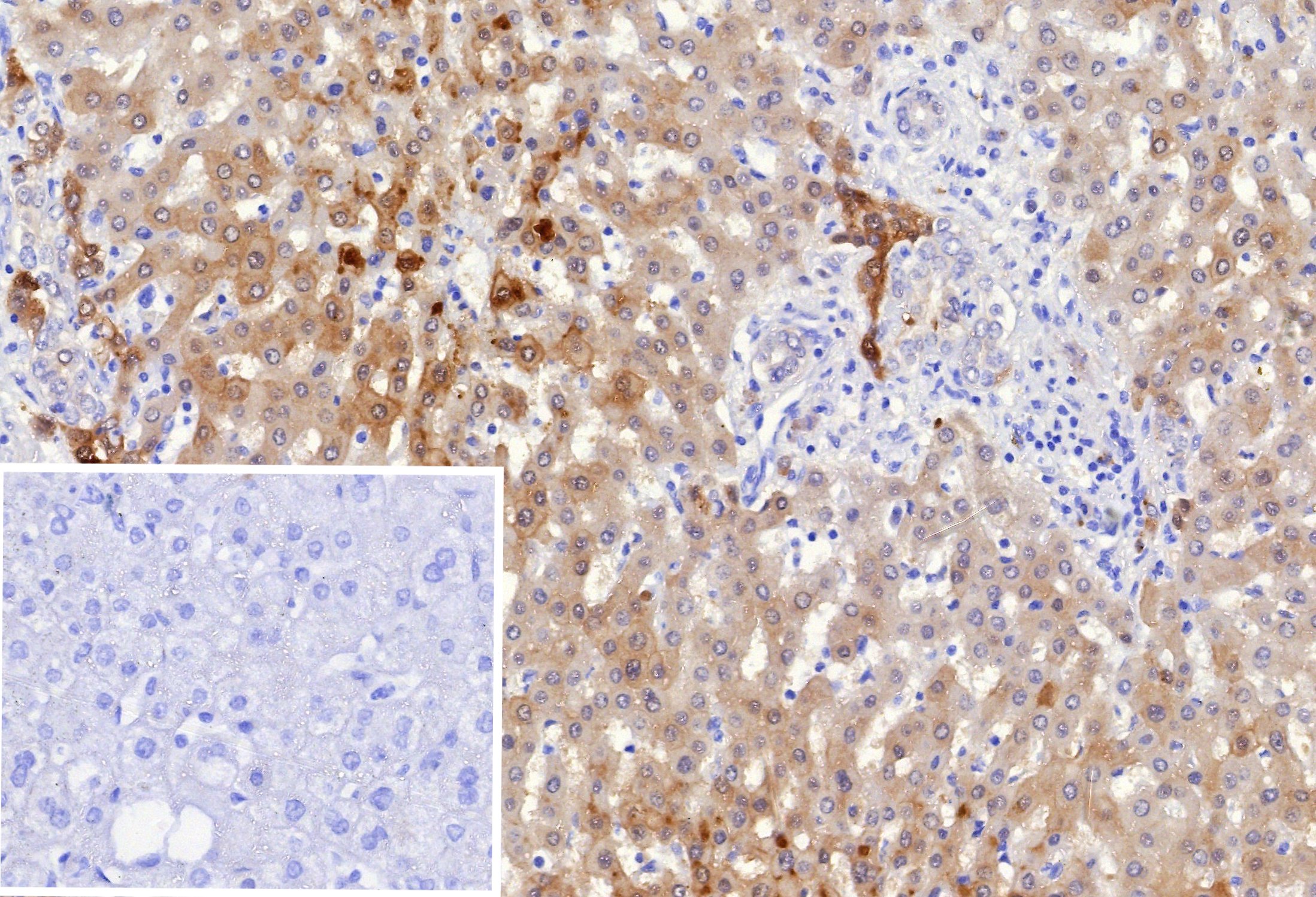 Aldo-keto Reductase 1C1/AKR1C1 Antibody (AKR1C1/9318) - Azide and BSA Free