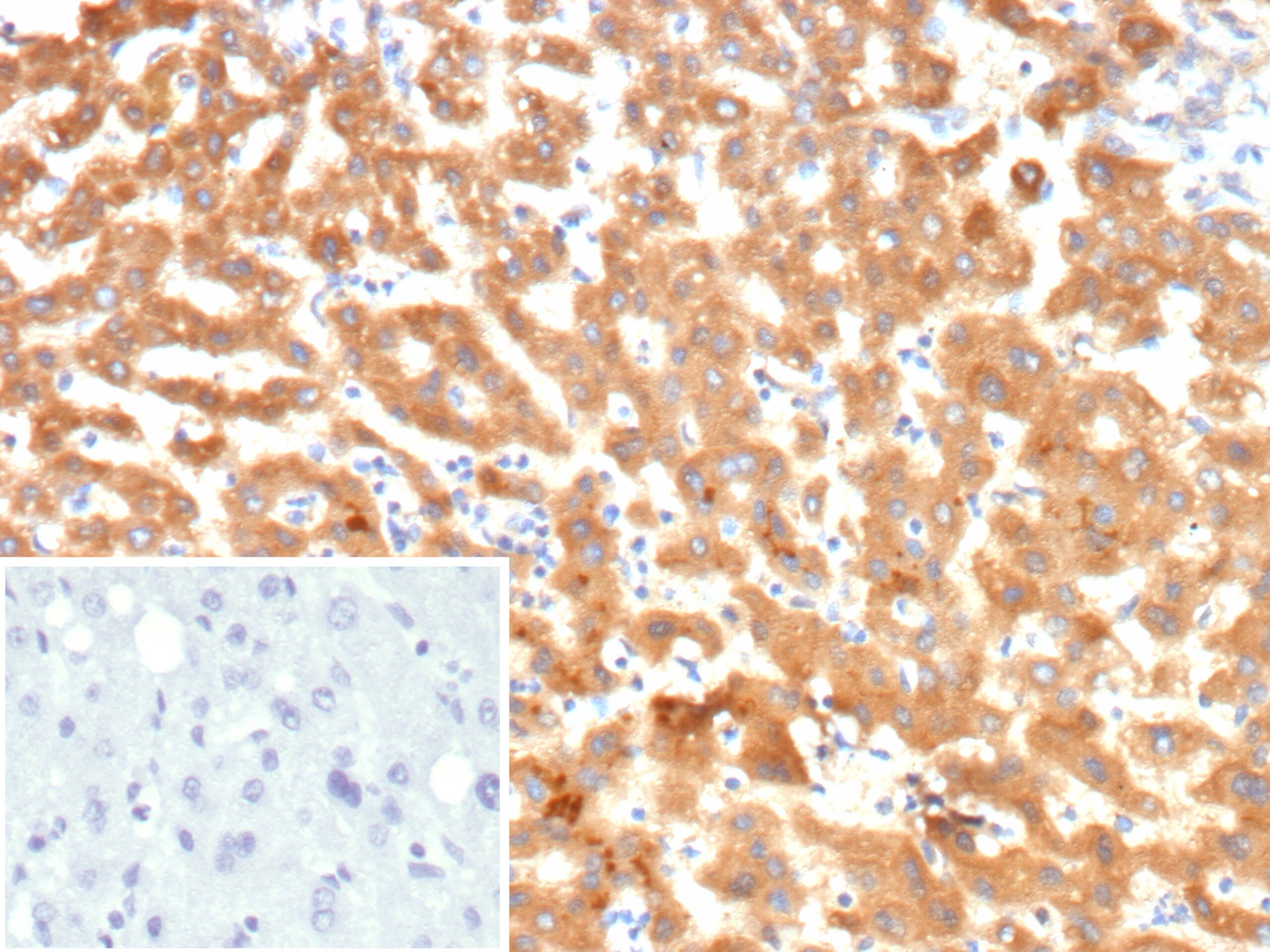 Kininogen 1 Antibody (KNG1/7422) - Azide and BSA Free