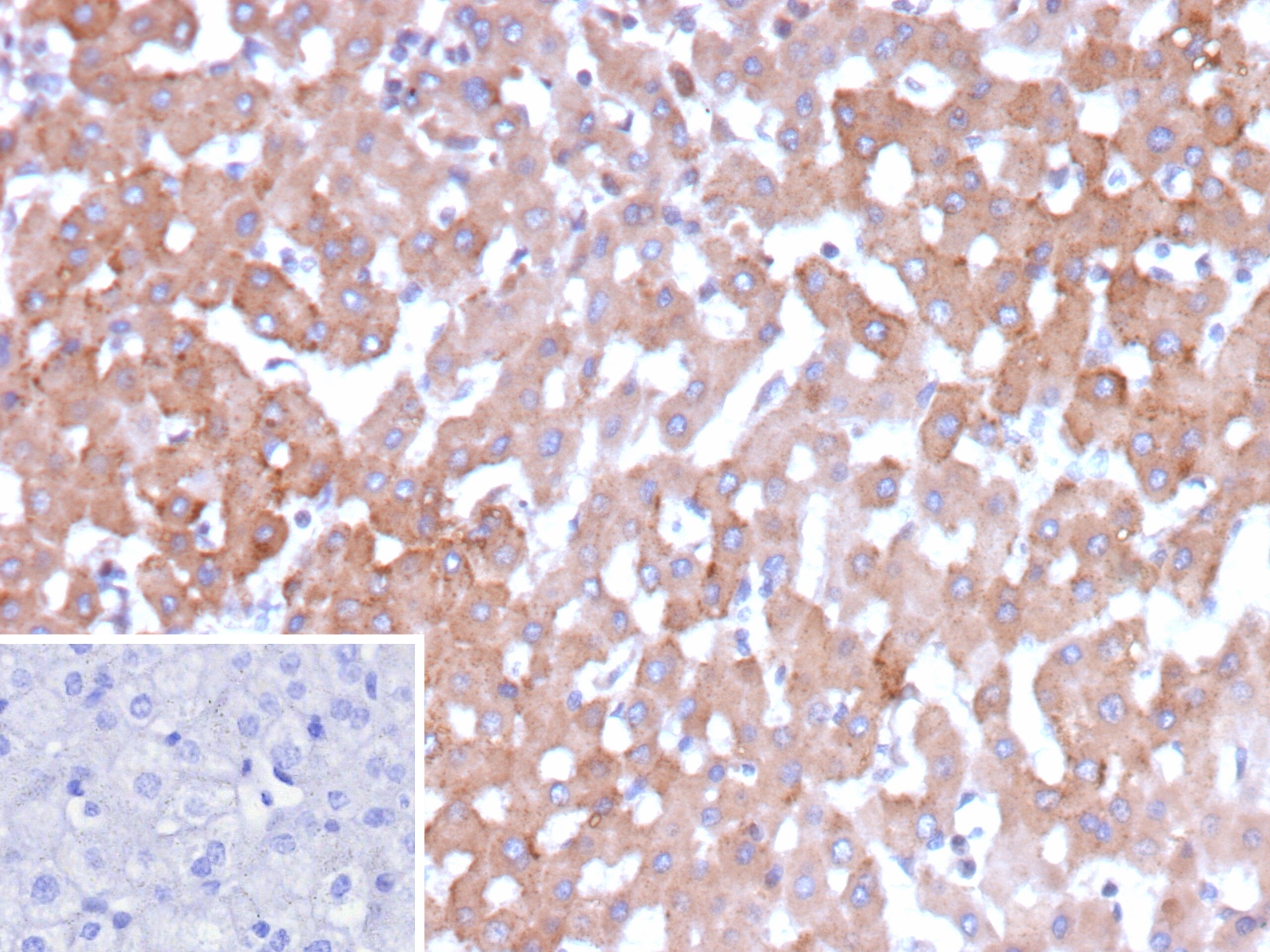HSD17B13 Antibody (HSD17B13/13109) - Azide and BSA Free