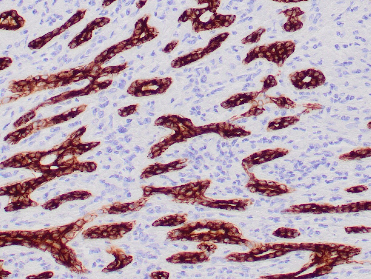 Cytokeratin 7, 8 Antibody (CAM5.2) - Azide and BSA Free