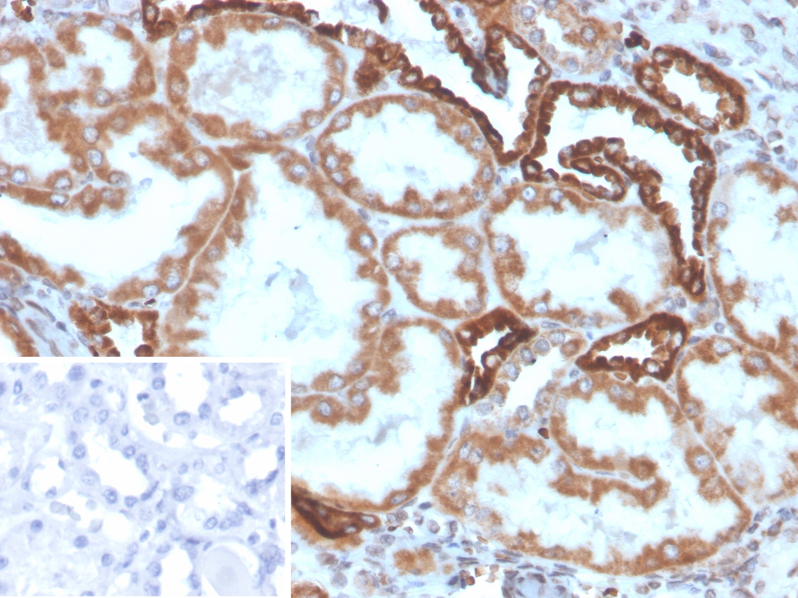 PLA2R1 Antibody (PLA2R1/4896) - Azide and BSA Free