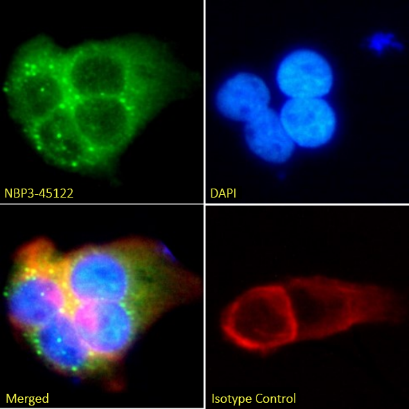 5T4 Antibody (12B12C7C3) - Chimeric - BSA Free 5T4 Antibody (12B12C7C3) - Chimeric - BSA Free