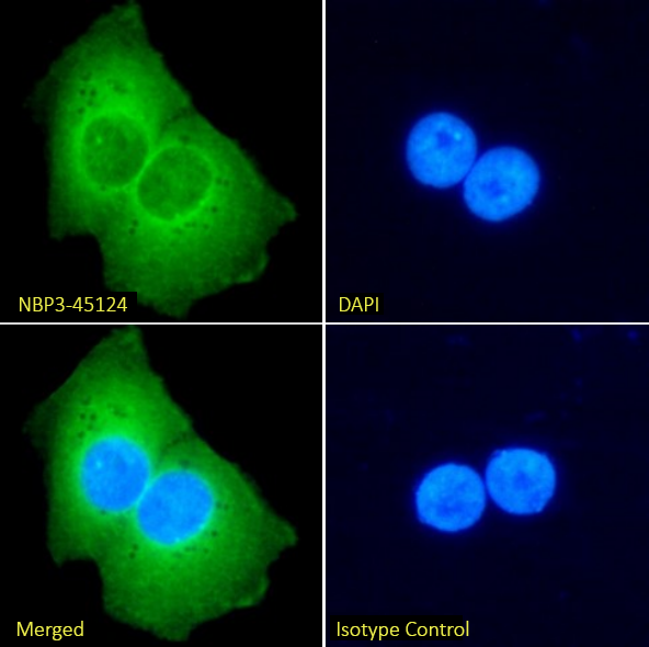 EpCAM/TROP1 Antibody (MT201 (HD69)) - Chimeric, (Research Grade adecatumumab Biosimilar) - BSA Free EpCAM/TROP1 Antibody (MT201 (HD69)) - Chimeric, (Research Grade adecatumumab Biosimilar) - BSA Free
