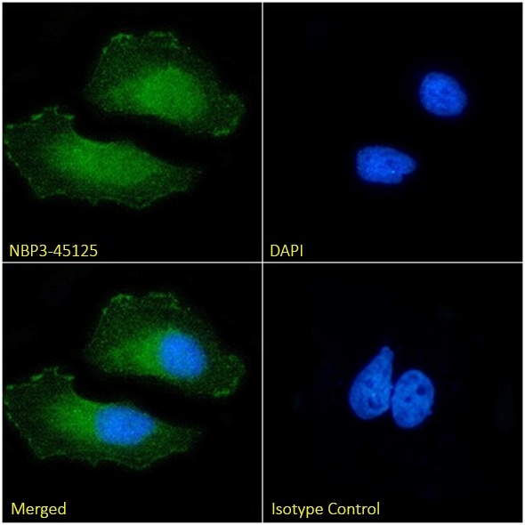 p16INK4a/CDKN2A Antibody (30859-S17) - Chimeric - BSA Free p16INK4a/CDKN2A Antibody (30859-S17) - Chimeric - BSA Free