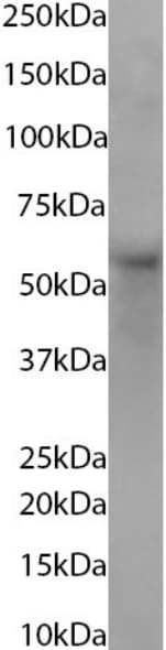 Glypican 1 Antibody (AbAb2-GPC1) - Chimeric - BSA Free Glypican 1 Antibody (AbAb2-GPC1) - Chimeric - BSA Free