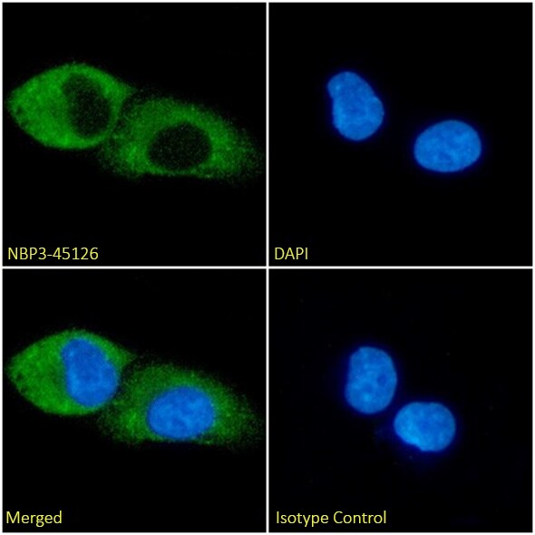 Glypican 1 Antibody (AbAb2-GPC1) - Chimeric - BSA Free Glypican 1 Antibody (AbAb2-GPC1) - Chimeric - BSA Free