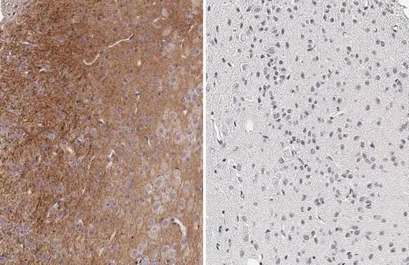 Tau [p Thr181] Antibody (HL2497) - Azide and BSA Free