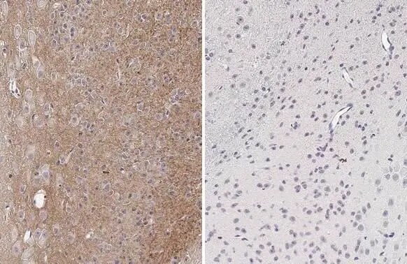 Tau [p Thr181] Antibody (HL2498) - Azide and BSA Free