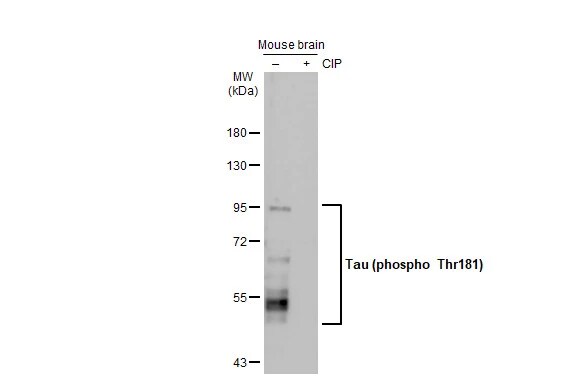 Tau [p Thr181] Antibody (HL2498) - Azide and BSA Free