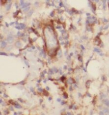 TOMM6 Antibody - BSA Free