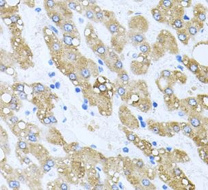 TOB2 Antibody - BSA Free