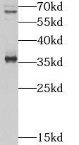 TOB2 Antibody - BSA Free