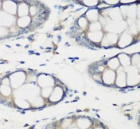 TNNC2 Antibody - BSA Free