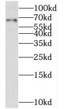 TXNDC10 Antibody - BSA Free