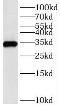 TMX2 Antibody - BSA Free