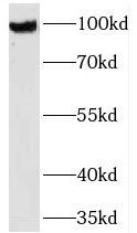 TMTC1 Antibody - BSA Free