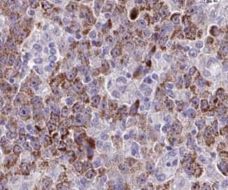 Tropomodulin 4 Antibody - BSA Free