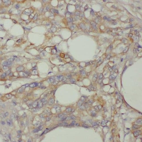 TMEM9B Antibody - BSA Free