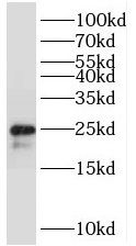 TMEM9B Antibody - BSA Free