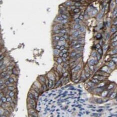 DRAM2 Antibody - BSA Free