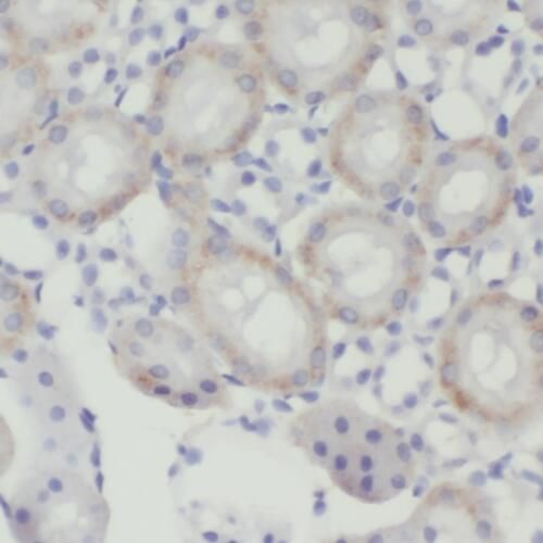 TMEM38B Antibody - BSA Free