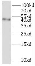 TMEM38B Antibody - BSA Free