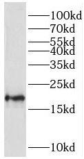 TMEM35 Antibody - BSA Free