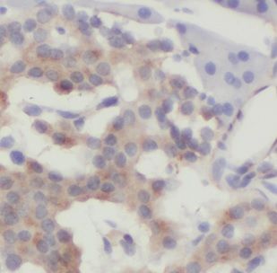 DNAJC21 Antibody - BSA Free