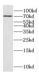 DNAJC21 Antibody - BSA Free