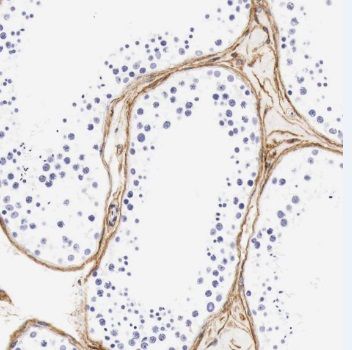 TMEM213 Antibody - BSA Free