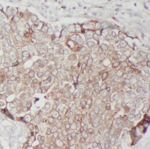 TMEM199 Antibody - BSA Free