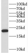 TMEM199 Antibody - BSA Free