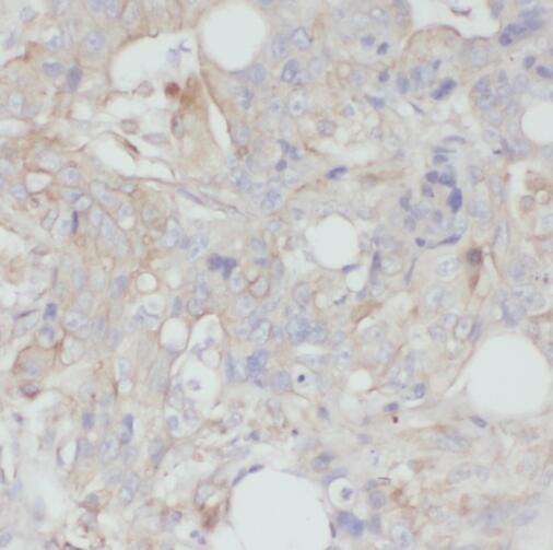 TMEM190 Antibody - BSA Free