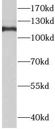 TMEM168 Antibody - BSA Free