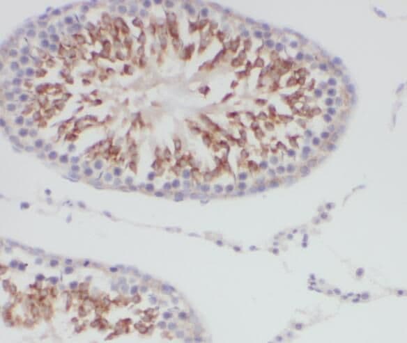 TMEM168 Antibody - BSA Free