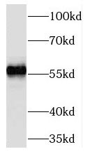 TMEM161A Antibody - BSA Free