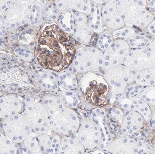 TMEM120B Antibody - BSA Free