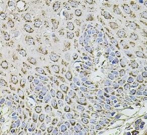 TMC1 Antibody - BSA Free