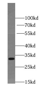 TIMMDC1 Antibody - BSA Free