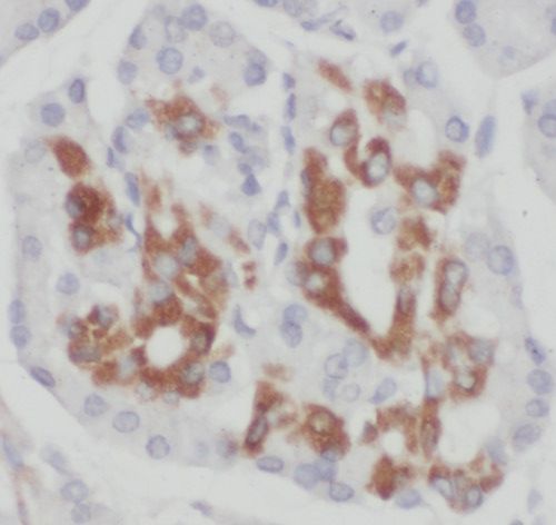 TIMM9 Antibody - BSA Free