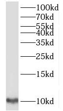 TIMM9 Antibody - BSA Free