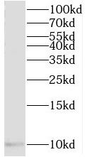 TIMM10 Antibody - BSA Free