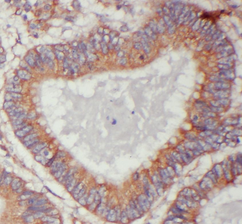 TIMM10 Antibody - BSA Free