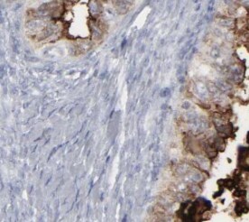 TIMM23 Antibody - BSA Free