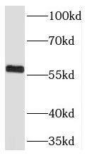 THUMPD3 Antibody - BSA Free