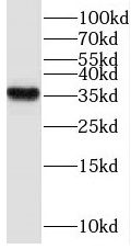 WDR58 Antibody - BSA Free