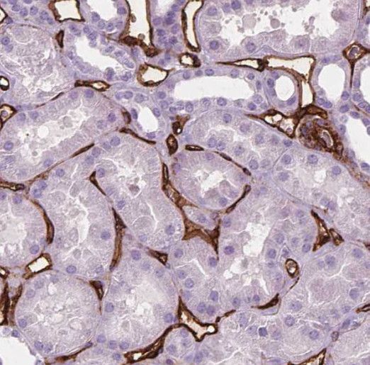 THEM2 Antibody - BSA Free